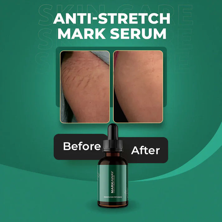 Mark Away Stretch Mark Remover Serum